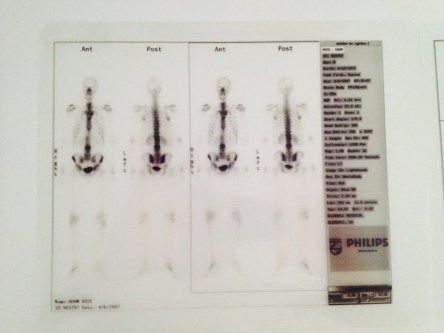 The author's CT scan